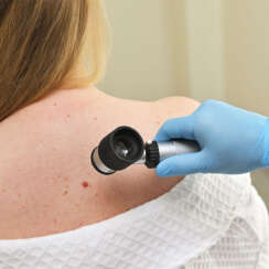 Visita dermatologica e mappatura dei nei: il nuovo servizio del Poliambulatorio Santa Lucia