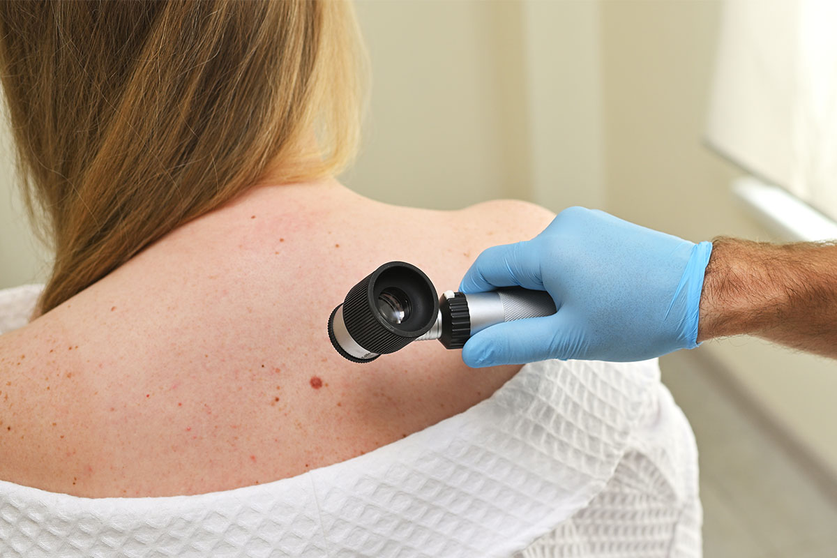 visita-dermatologica-e-mappatura-nei-Poliambulatorio-Santa-Lucia