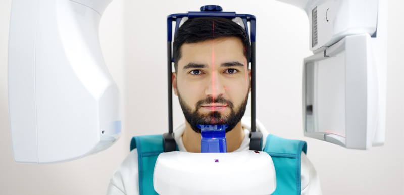 Radiografia, Panoramica dentale e TAC 3D Cone Beam a Lecce